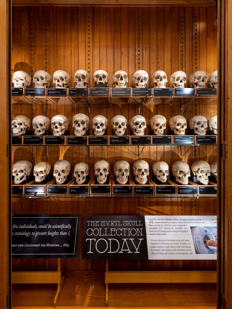 Hyrtl Skull Collection