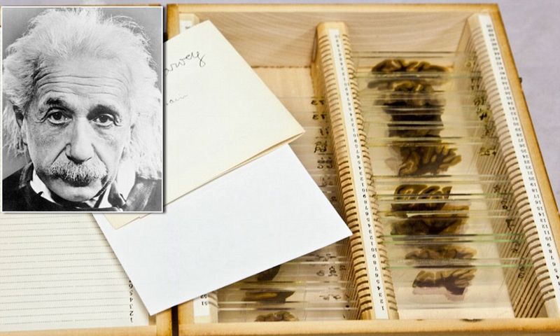 Albert Einstein's Brain