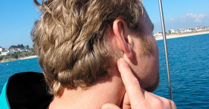 Scopolamine patch: how and when