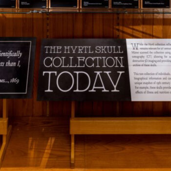 Inside Philly’s Mutter Museum: Home to Einstein’s Brain and Medical Marvels